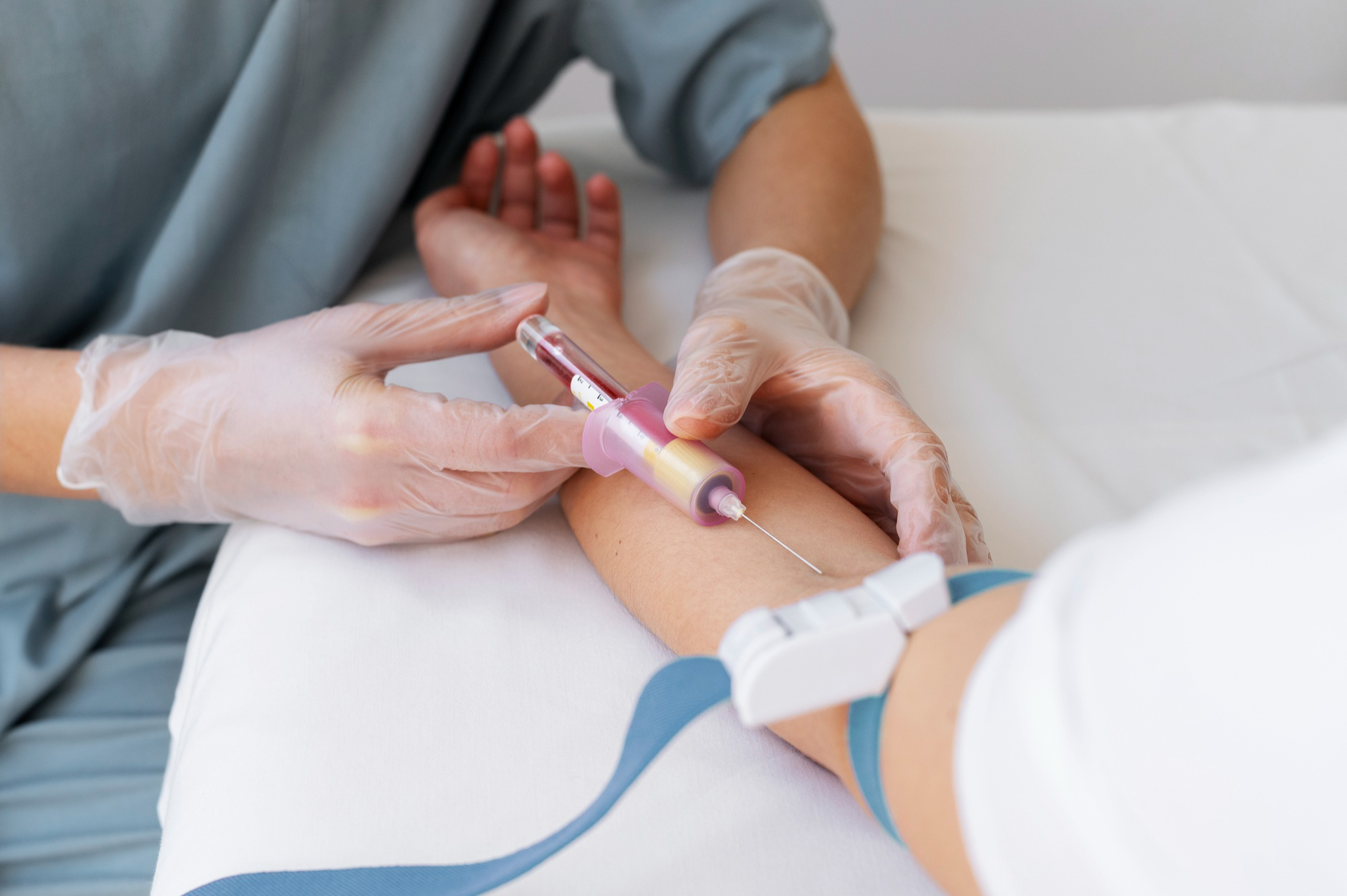 Blutgeltherapie