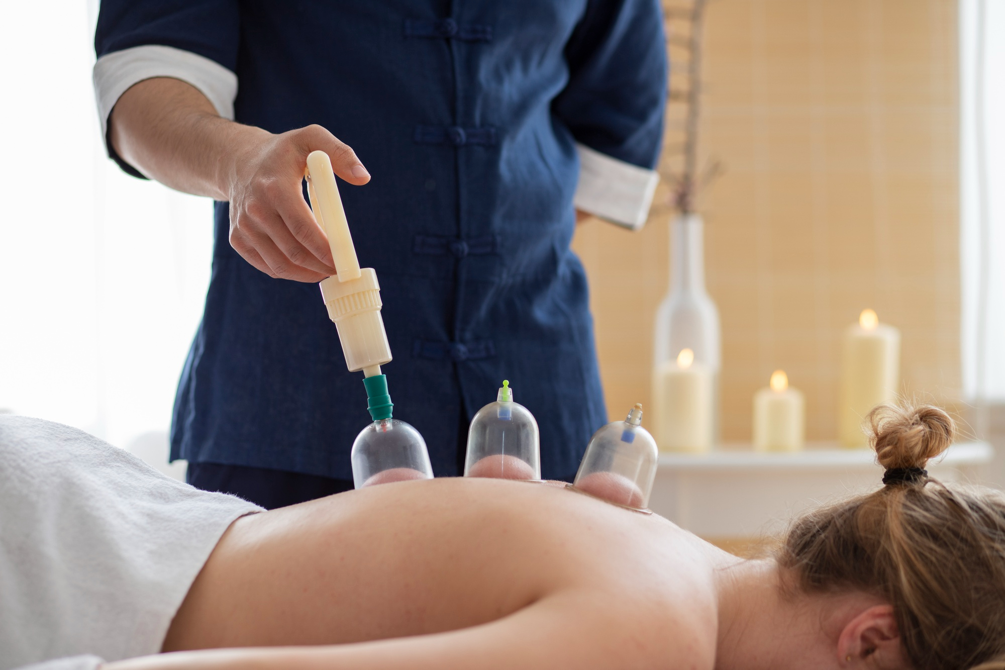 Schröpfen / Hijama